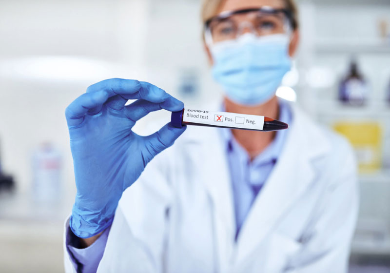 Laboratuvarda test örneği inceleyen sağlık çalışanı